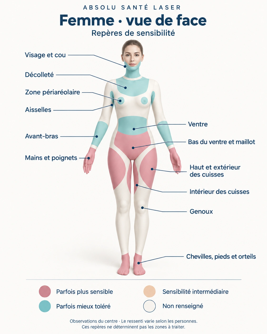 Repères de sensibilité à l’épilation laser : femme — vue de face, selon les observations du centre Absolu Santé Laser.