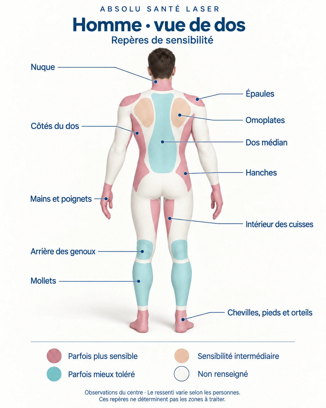 Repères de sensibilité à l’épilation laser : homme — vue de dos, selon les observations du centre Absolu Santé Laser.