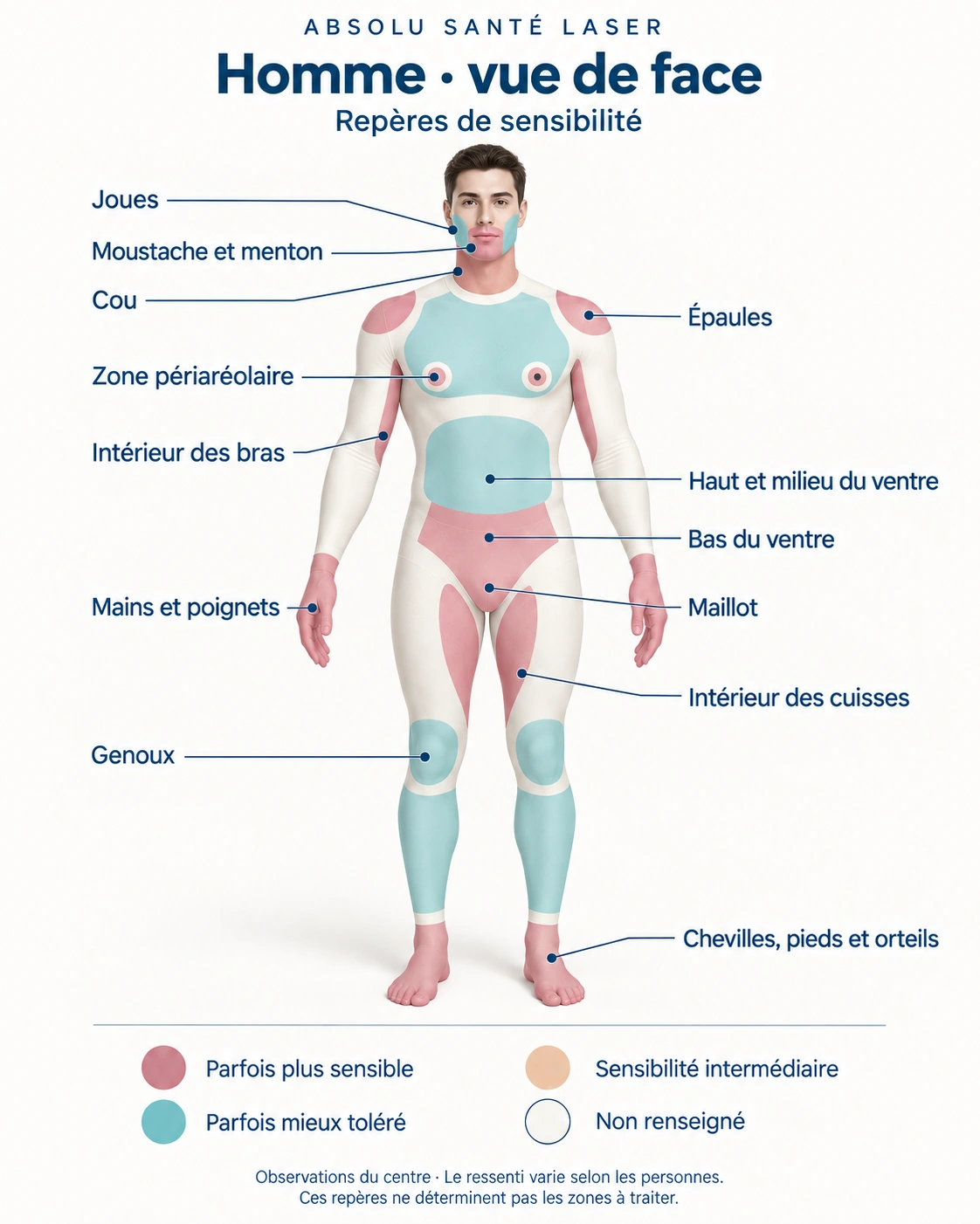Repères de sensibilité à l’épilation laser : homme — vue de face, selon les observations du centre Absolu Santé Laser.